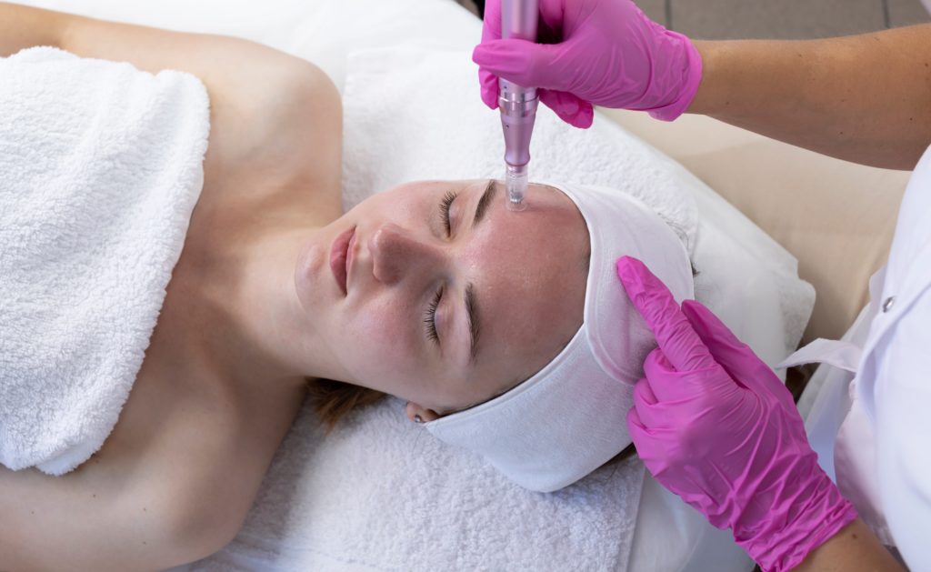 RF Microneedling Treatment in Spring, TX | Savvy Chic Medspa