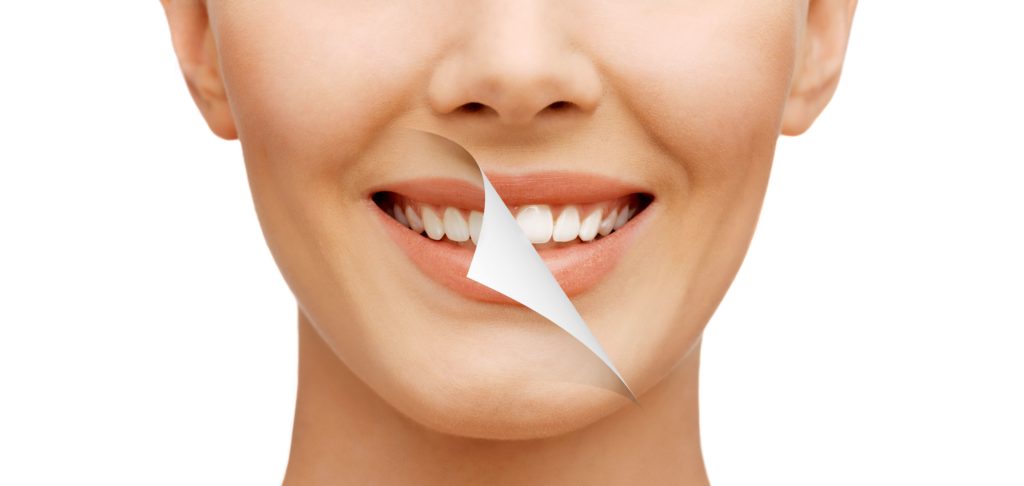 Teeth Whitening in Spring, Texas | Savvy Chic Medspa