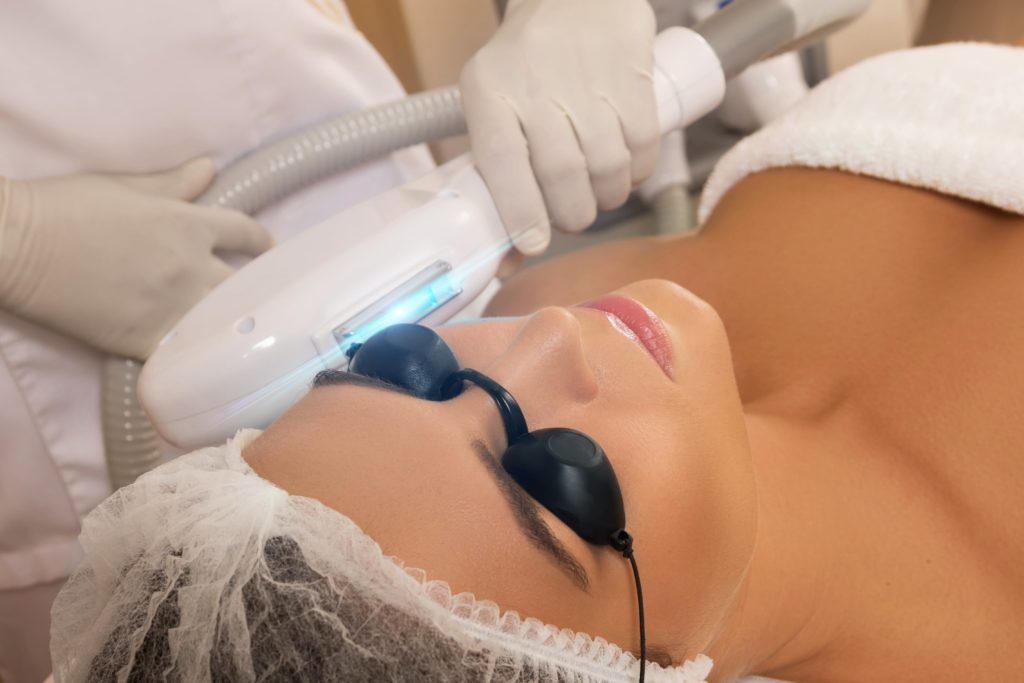 IPL Photofacial Service in Spring, Texas | Savvy Chic Medspa