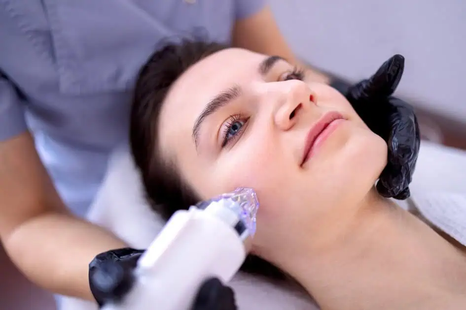 RF Microneedling by Savvy Chic Medspa in Spring, TX