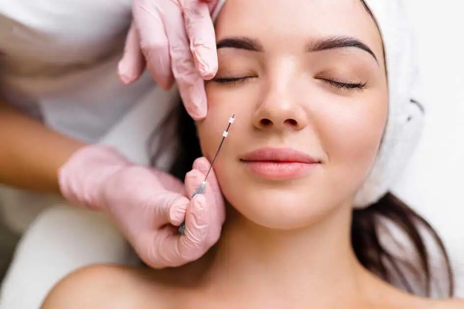 PDO Max Thread Lift in Spring, TX by Savvy Chic Medspa