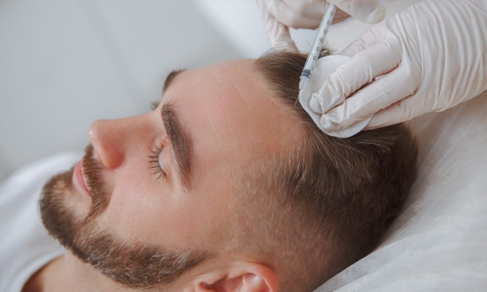 What is Better, a Hair Transplant or PRP?